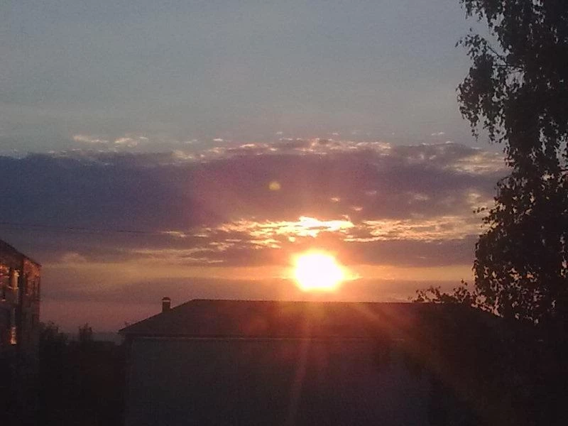 Медик Асеева: Плохая переносимость солнца является возможным симптомом красной волчанки